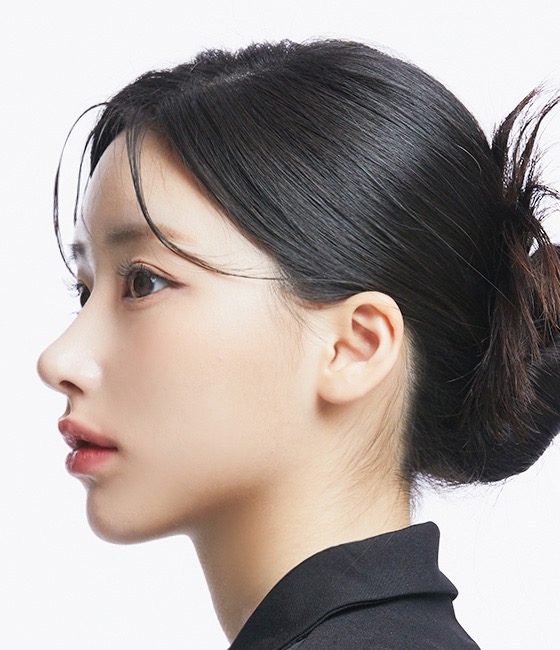 TIANA 整形外科 自然側臉線條（模特兒形象照）