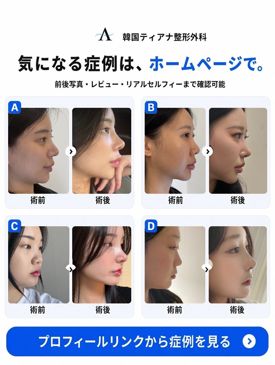 横顔の症例集、術前から術後にかけての鼻の変化